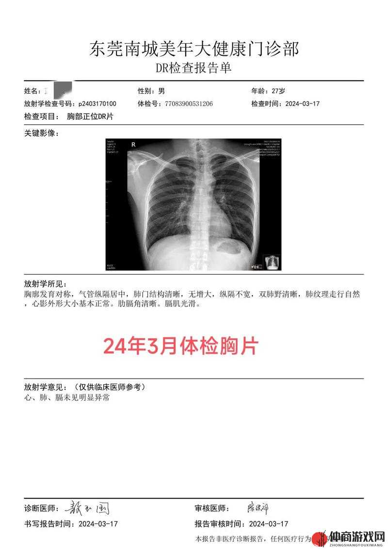 关于 100% 胸片曝光的全面解读与分析